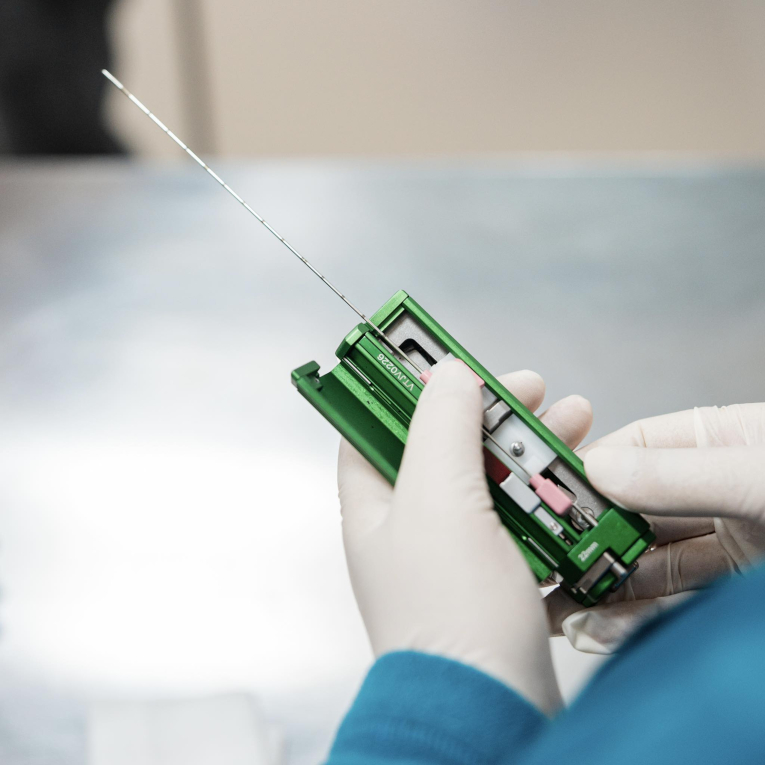 Ბიოფსია1