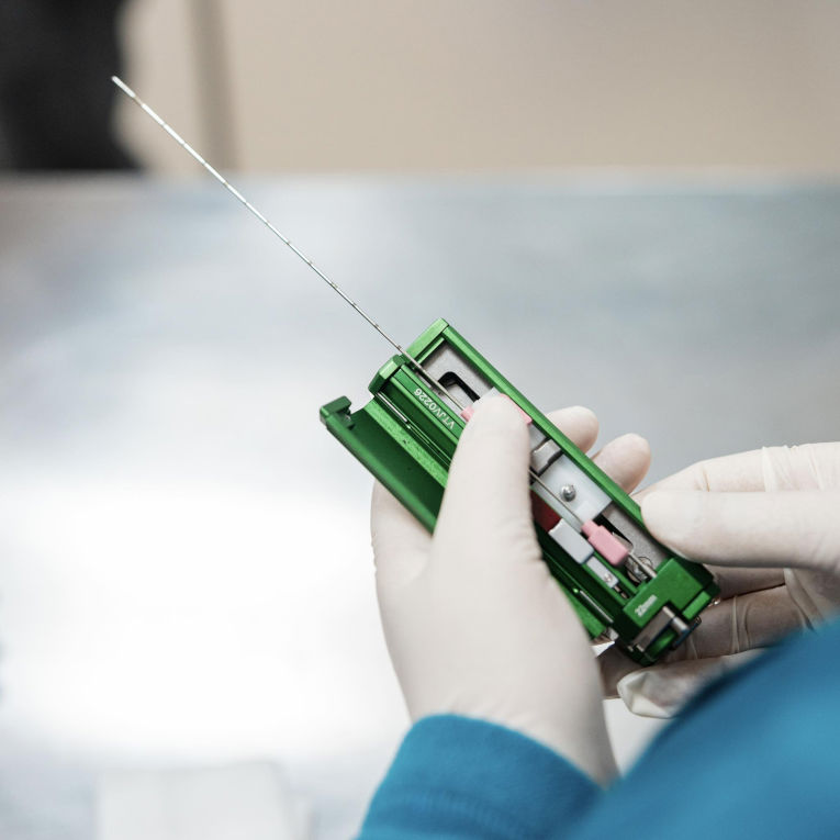 Ბიოფსია1