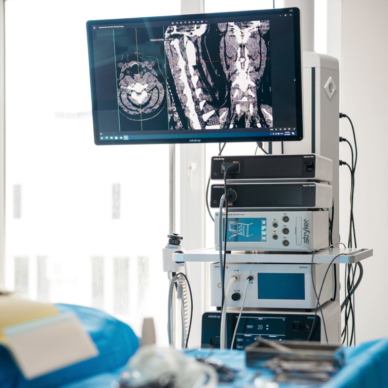 Bigli3