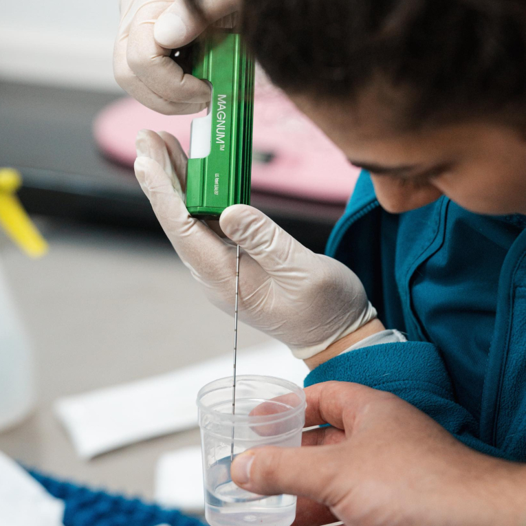 Ბიოფსია3